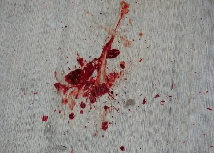 Τραγικό: Άνδρας μαχαιρώθηκε θανάσιμα σε διαμάχη για χώρο στάθμευσης αυτοκινήτων